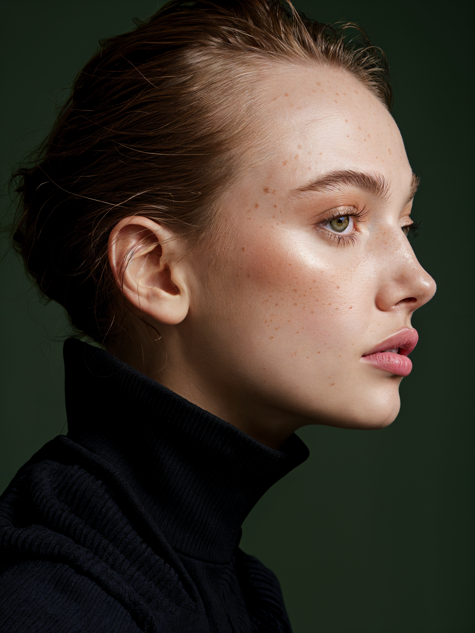 karpiuk-Rejuvenescimento-Bioestimuladores